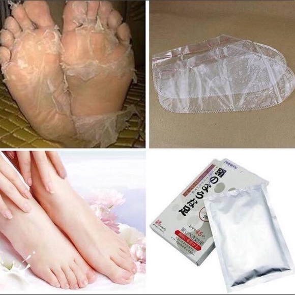 Other - Foot Peel